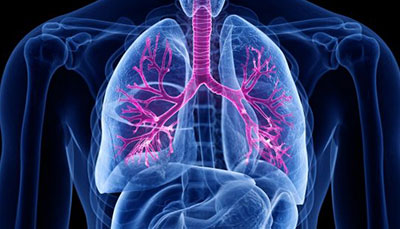 什么是慢性阻塞性肺病 (Chronic Obstructive Pulmonary Disease)，為何與新冠疫情有關(guān)？